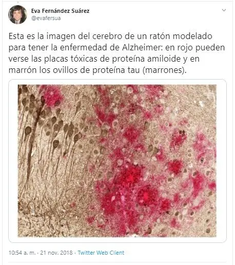 Immagine 2 Tweet Cervello con Alzheimer Traduzione Immagine 2 Questa è - фото 2