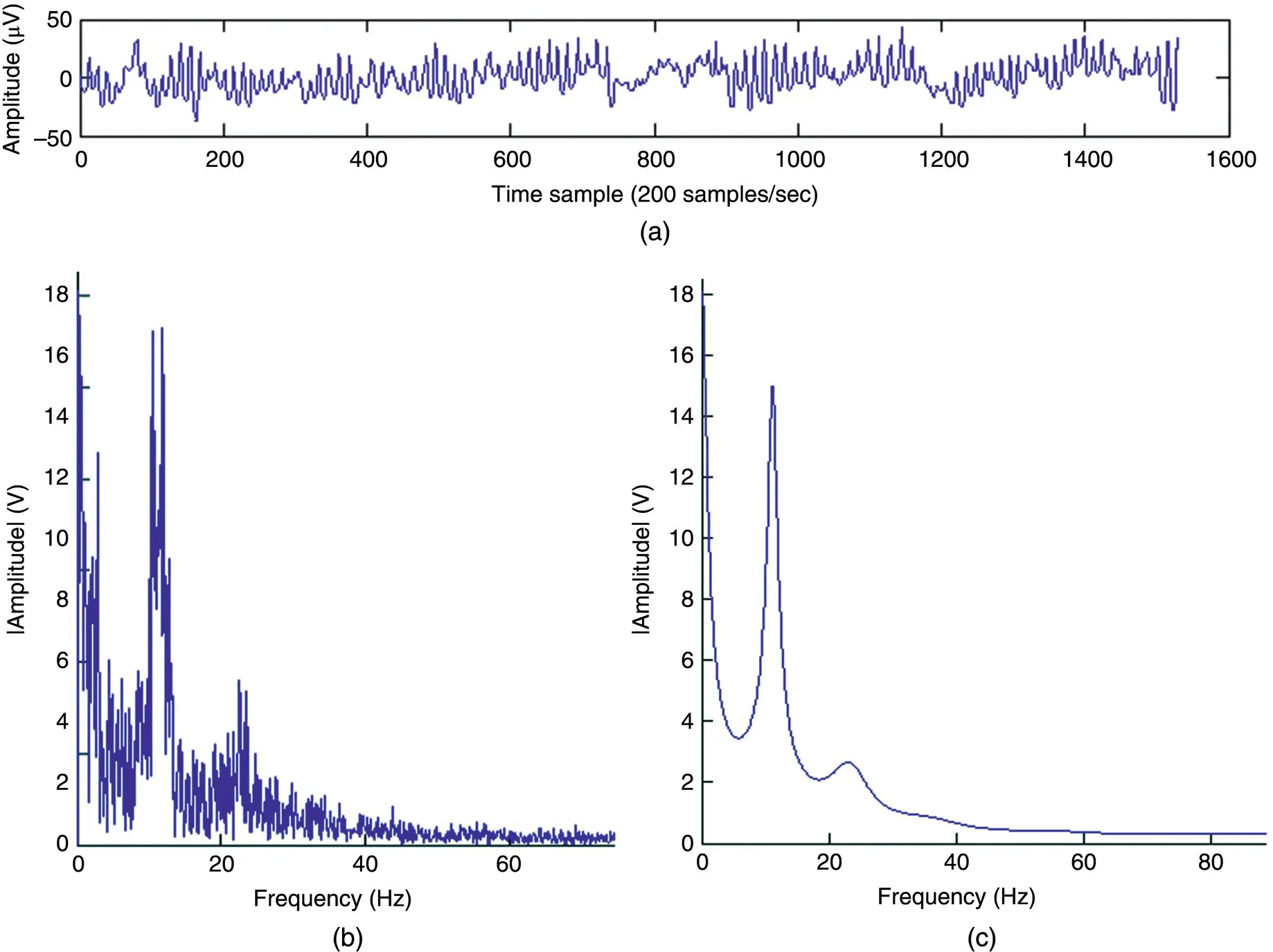 Figure 43 Singlechannel EEG spectrum a A segment of an EEG signal with a - фото 154