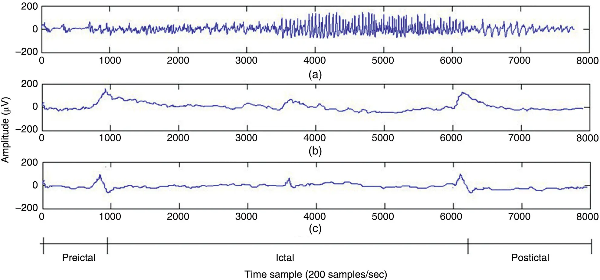 Figure 42 a An EEG seizure signal including preictal ictal and postictal - фото 150