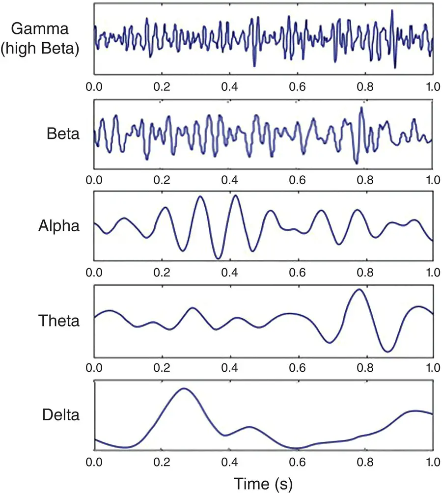 Figure 21 Five can be categorized as four typical dominant brain normal - фото 12