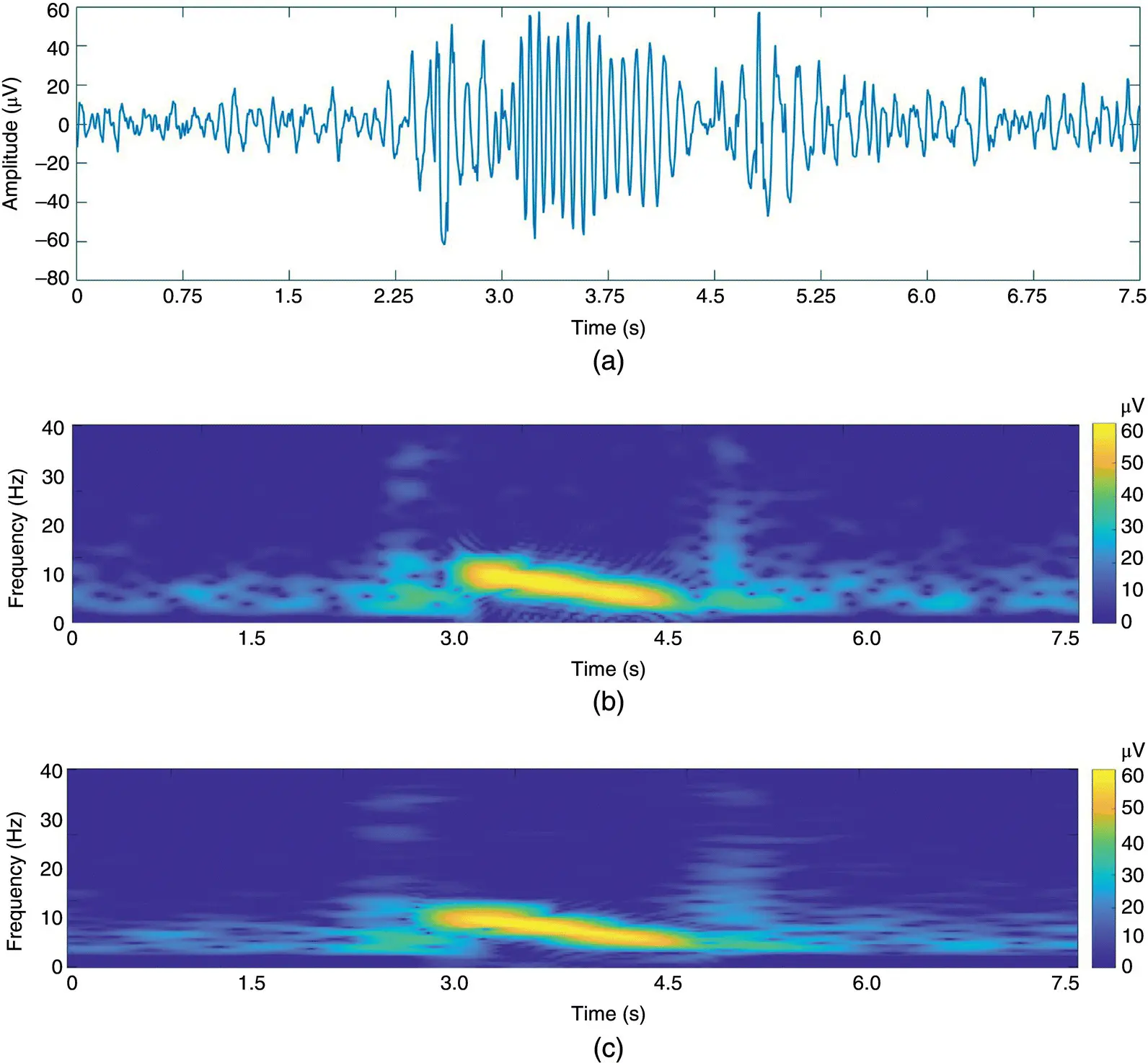 Figure 44 TF representation of an epileptic waveform in a for different time - фото 163