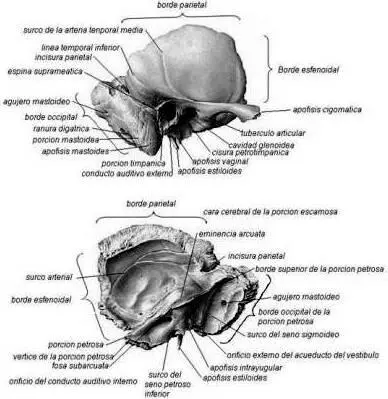 Compendio de anatomía normal de oído por tomografía computada helicoidal 3D - фото 11
