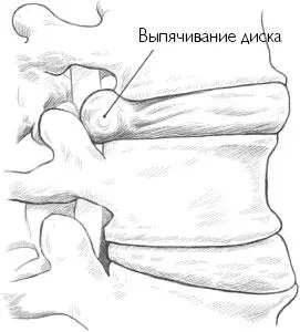 На это есть структурные причины это конечные опорные позвонки и сочетание - фото 13