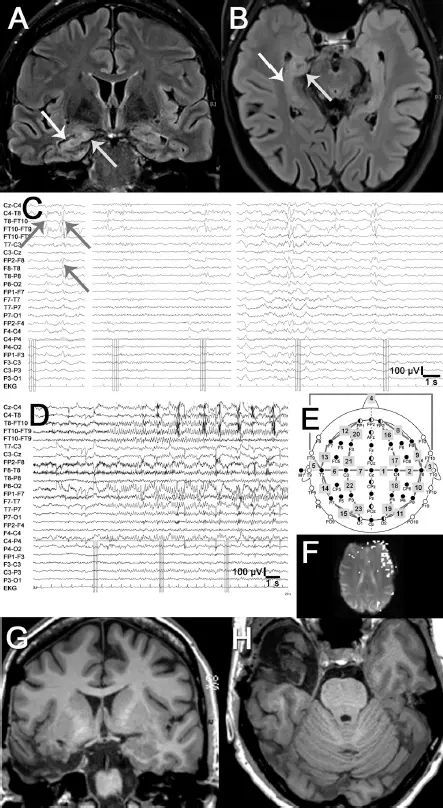 Abb 11 Prächirurgische Diagnostik bei der Patientin des Fallbeispiels 11 - фото 9