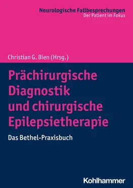 Неизвестный Автор Prächirurgische Diagnostik und chirurgische Epilepsietherapie обложка книги