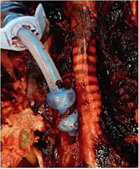 Abb A31 Paratracheale Lage Original Buschmann A31 Anatomie Am - фото 16