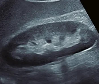 Fig 16a Fig 16a corte longitudinal que muestra un riñón derecho el cual - фото 37