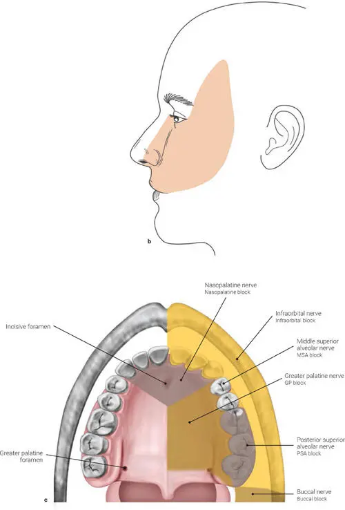 FIG 111 a The maxillary nerve nnerve CN V1ophthalmic nerve CN - фото 16