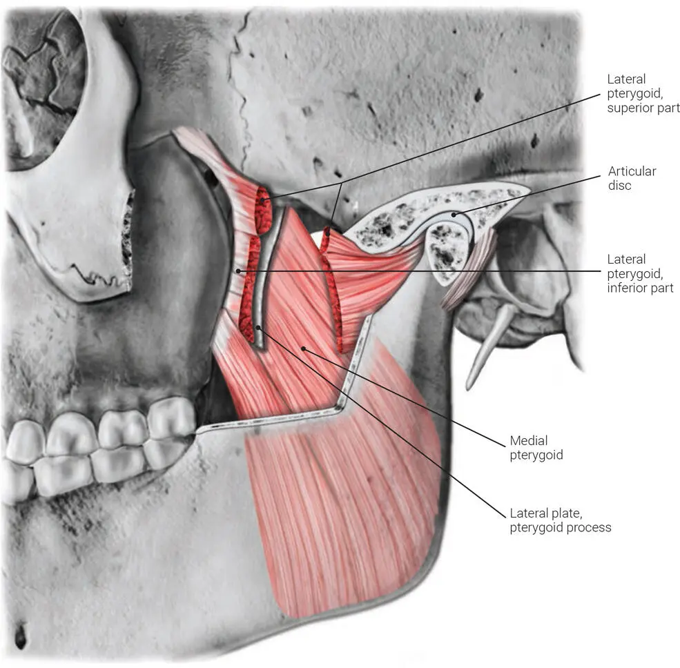 FIG 28 Lateral view of insertion of the medial pterygoid muscle FIG 29 - фото 27