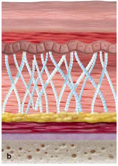 FIG 15Some dermal filler products stimulate the production of collagen and - фото 10