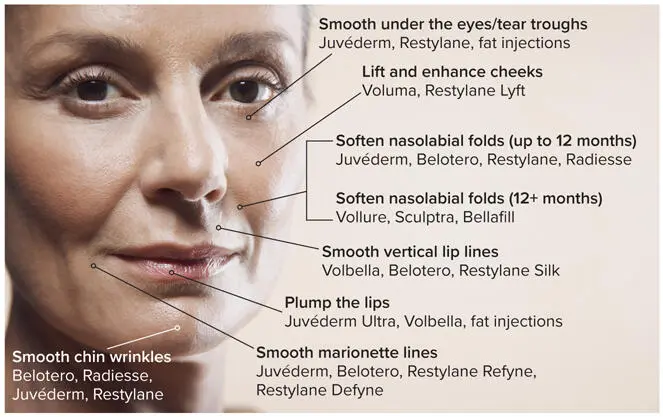 FIG 31Dermal filler products have been FDA cleared for specific treatments but - фото 33