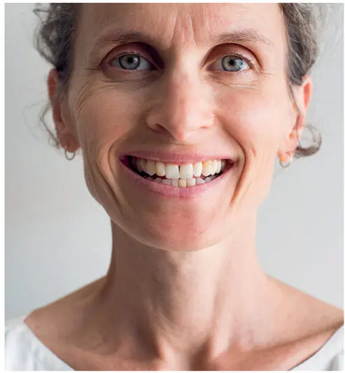 FIG 13Neurotoxins target the dynamic lines and folds of facial expression - фото 7