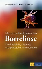 Werner Kühni - Naturheilverfahren bei Borreliose - eBook