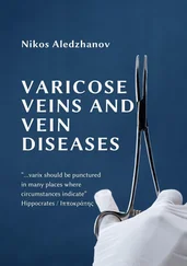 Nikos Aledzhanov - VARICOSE VEINS AND VEIN DISEASES