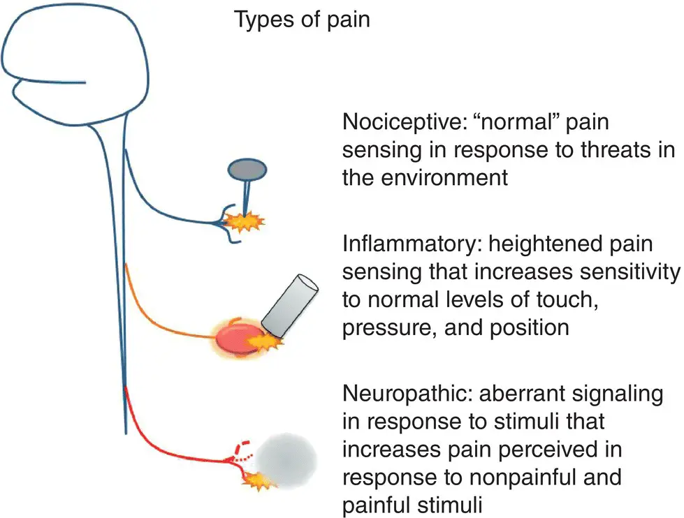 Figure 31 The basic mechanisms of pain Figure 32 How basic pain mechanisms - фото 9