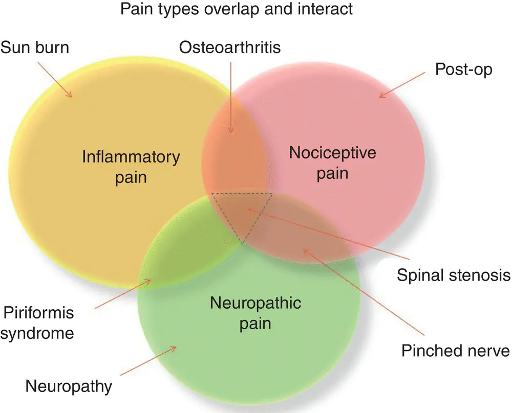 Figure 32 How basic pain mechanisms interact Nociceptive painis pain arising - фото 10