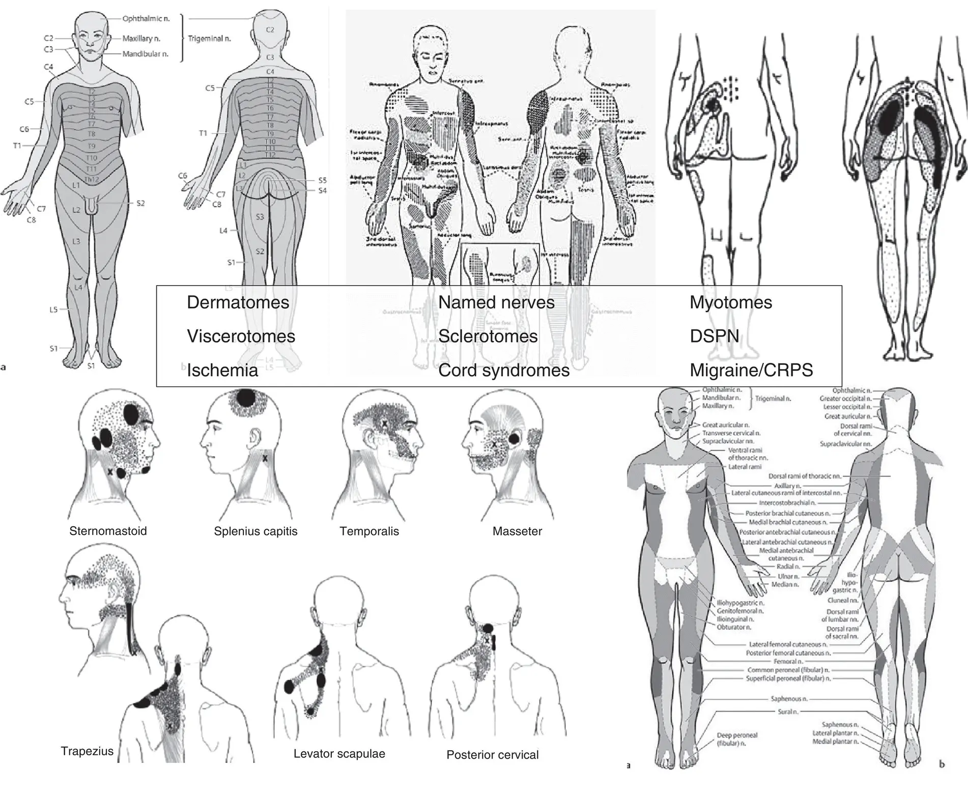 Figure 61 Pain patterns examples Pain can present with many different - фото 16