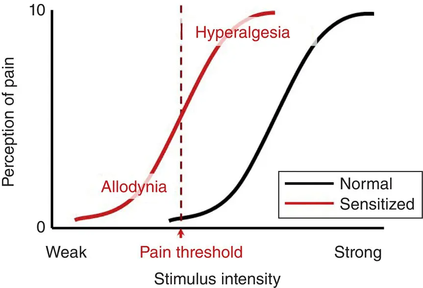 Figure 33 Stimulus response curve normal and abnormal pain perception In - фото 11