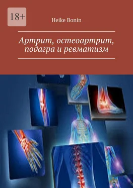 Heike Bonin Артрит, остеоартрит, подагра и ревматизм обложка книги