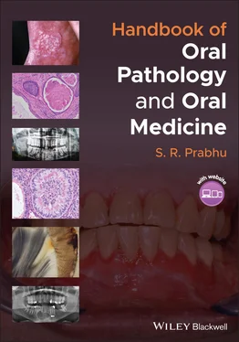 S. R. Prabhu Handbook of Oral Pathology and Oral Medicine обложка книги