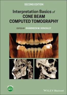 Неизвестный Автор Interpretation Basics of Cone Beam Computed Tomography обложка книги