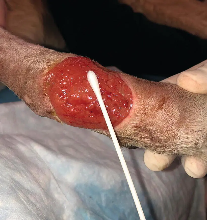 Figure 31 For the Levine technique the swab is contacting the wound bed only - фото 22
