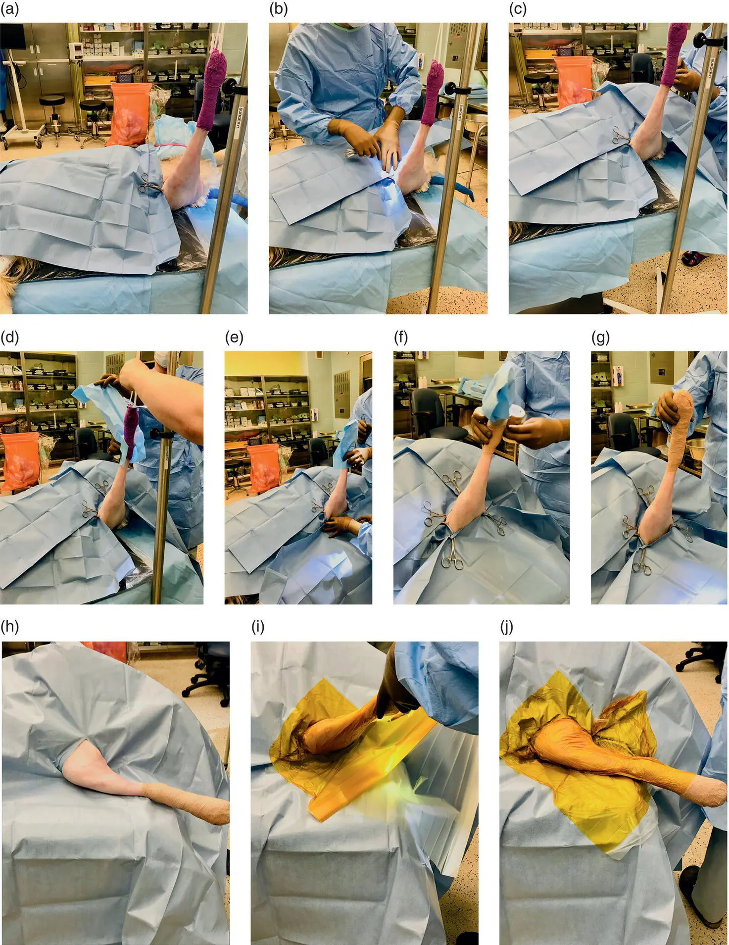 Figure 27 Following final skin preparation in the OR with the limb suspended - фото 21