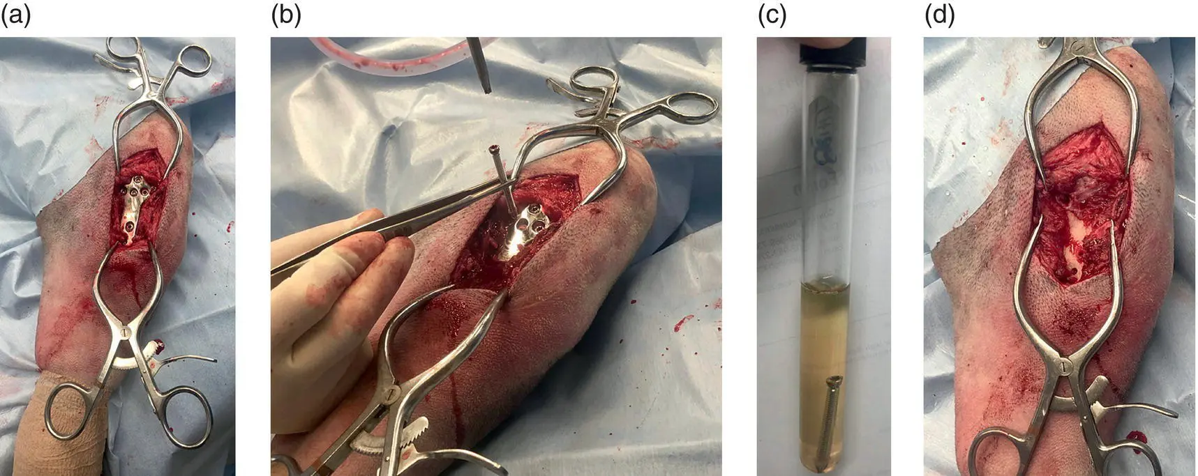 Figure 36 aExposed TPLO plate bScrew removed When removing screws to - фото 27
