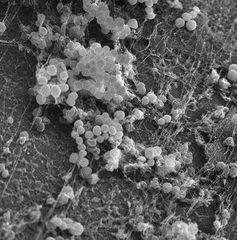Figure 34 Scanning electron microscopy image of a biofilm Source Adapted - фото 25