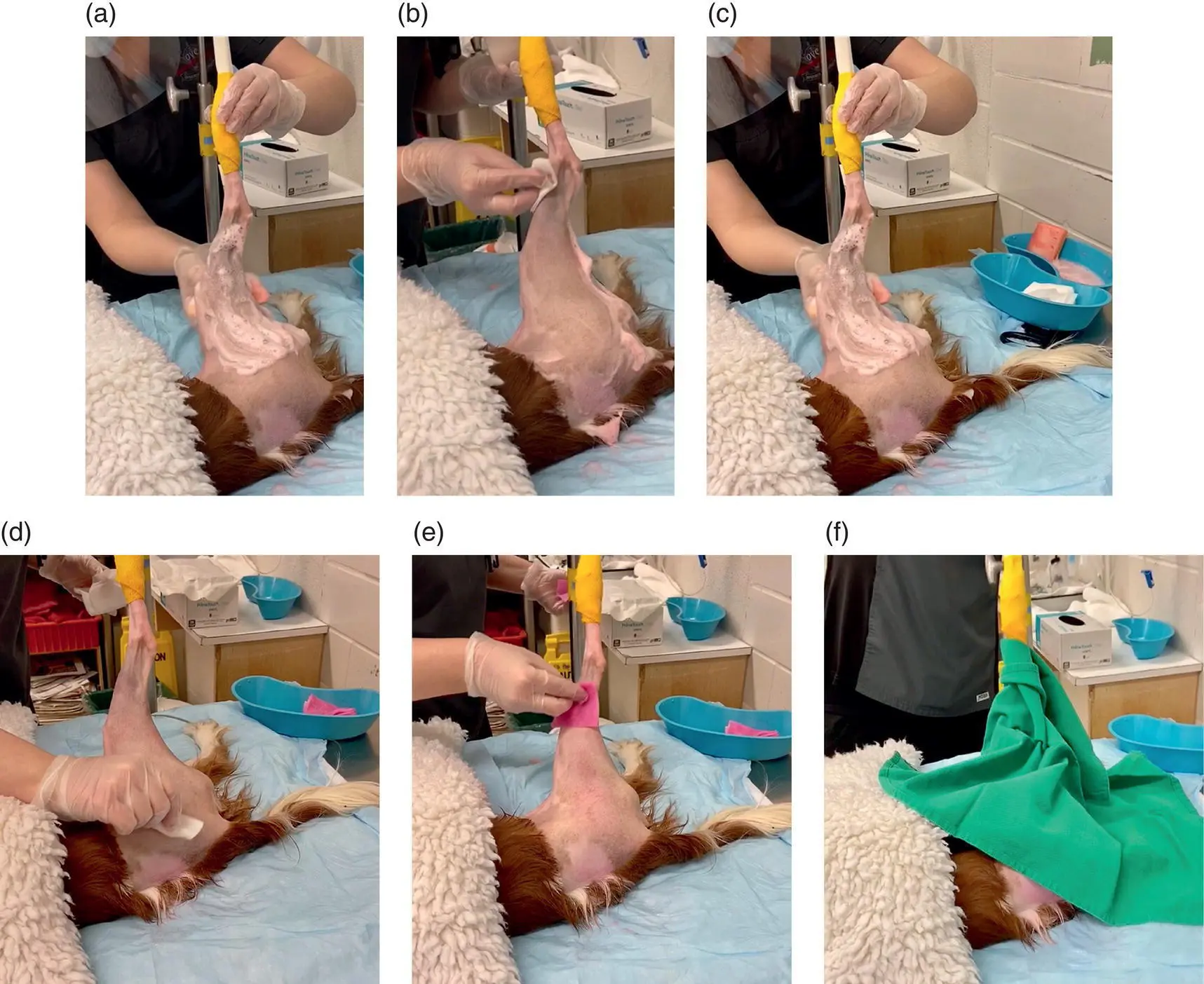 Figure 23 Skin preparation steps Note the assistant is wearing nonsterile - фото 17