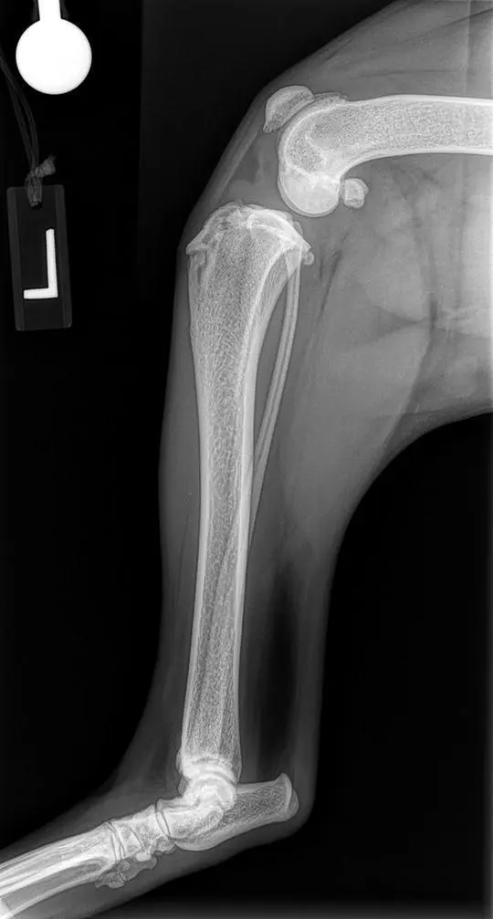 Figure 19 A lateral radiograph documenting appropriate positioning of the - фото 10
