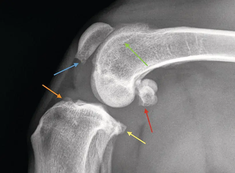 Figure 112 Evidence of degenerative changes in the stifle of a patient with - фото 13