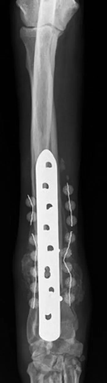 Figure 35 In this craniocaudal view of the antebrachium two discontinuous - фото 26