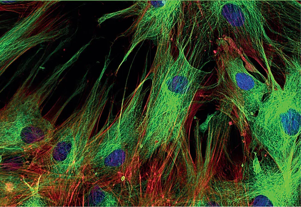 Vorwort Das Training der Faszien findet in der wissenschaftlichen Forschung - фото 8