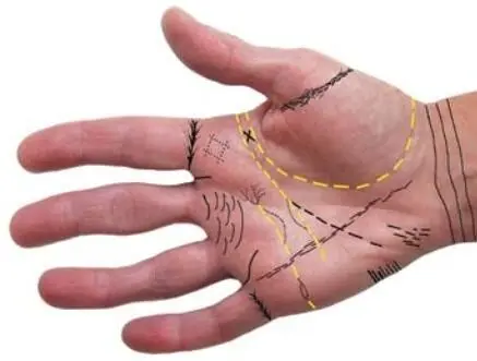 Diagnostik über die Handinnenfläche Die sogenannte Chirologie A Säbelartige - фото 4