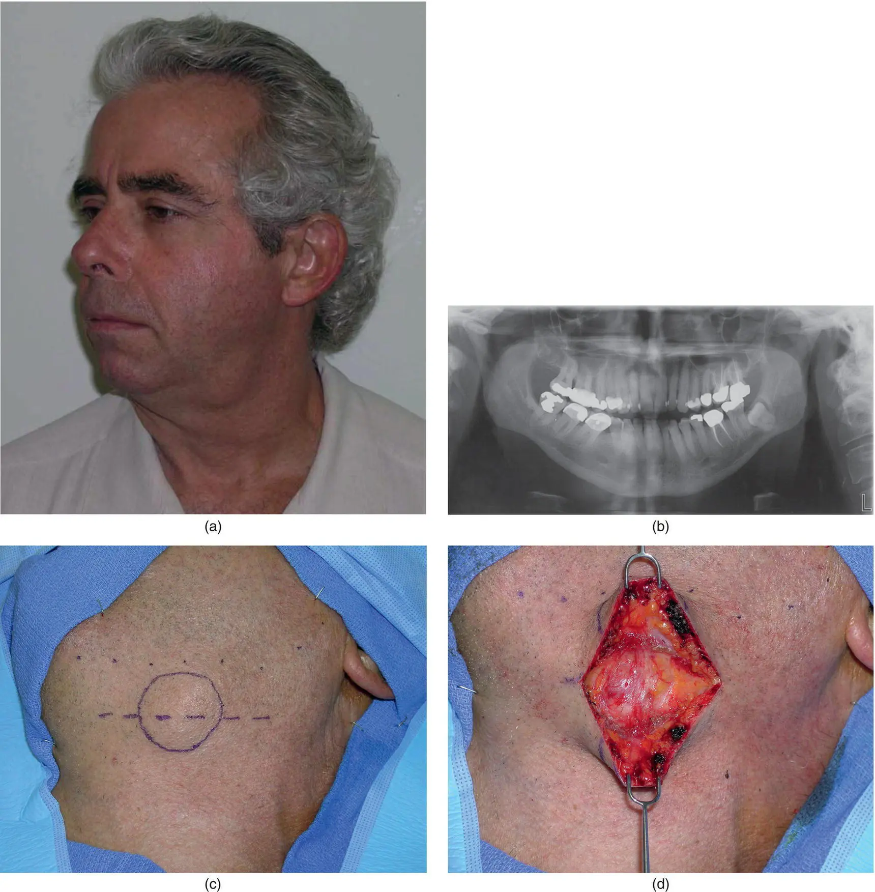 Figure 315 A 52yearold man a with - фото 129