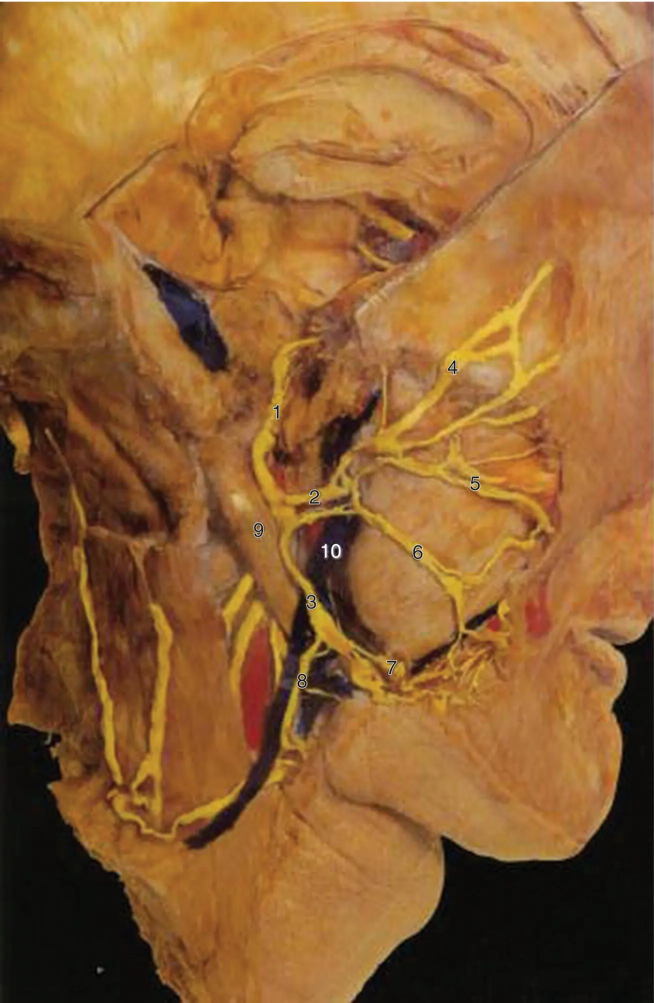 Figure 17 The facial nerve and its relationship to the retromandibular vein - фото 12