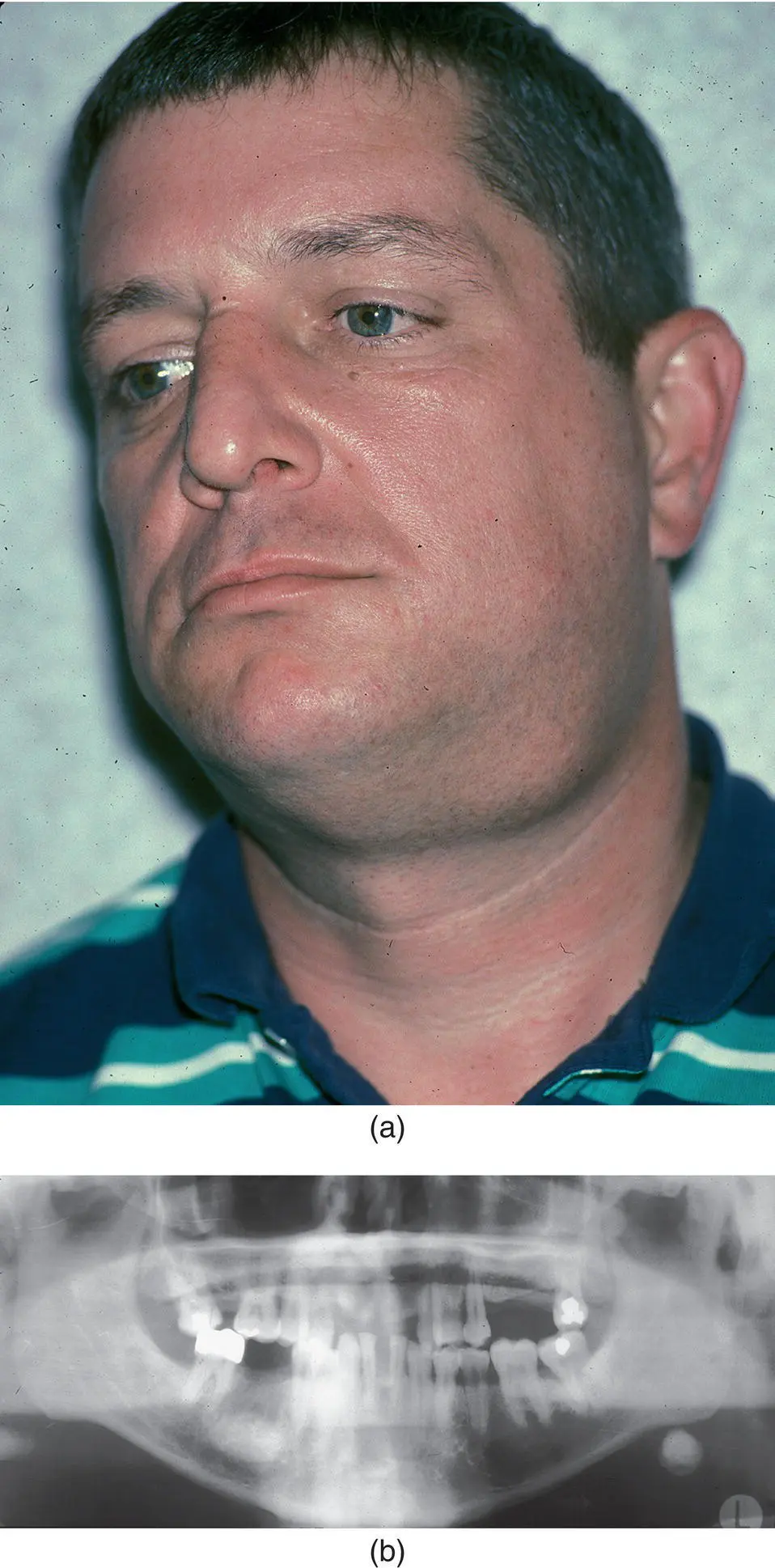 Figure 32 A 45yearold man a with a sixmonth history of left - фото 112