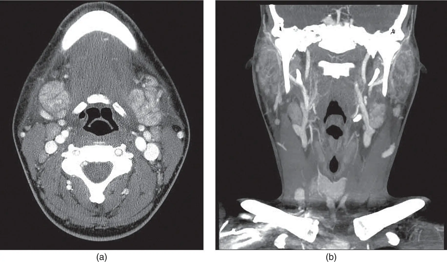 Figure 318 Axial a and coronal b CT images demonstrating contrast - фото 135