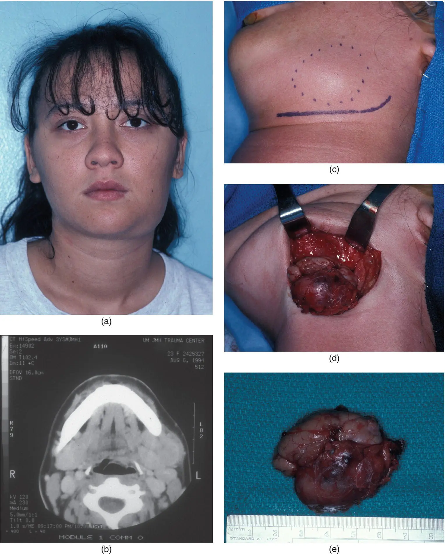 Figure 316 A 21yearold woman a with a twoweek history of left - фото 132