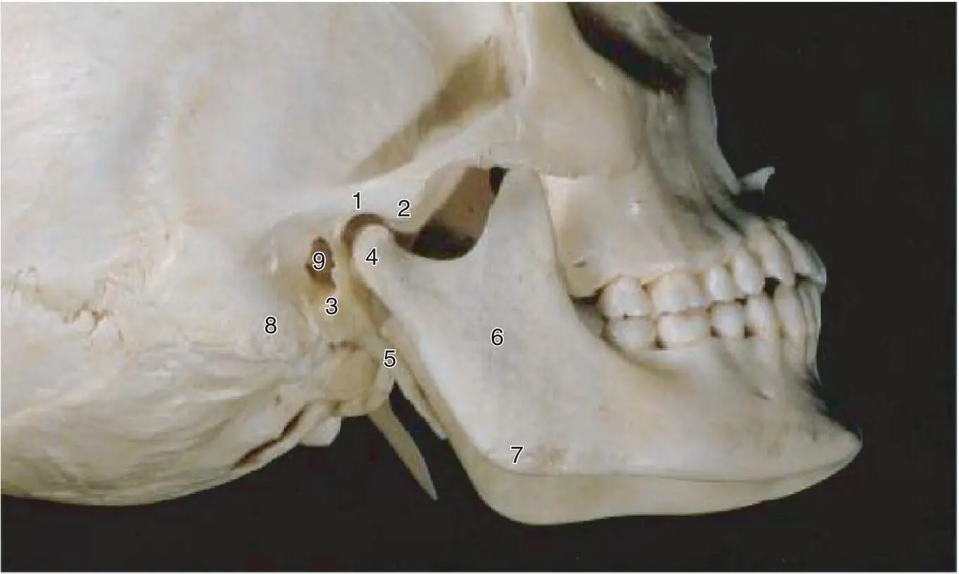 Figure 11 A lateral view of the skull showing some of the bony features - фото 6