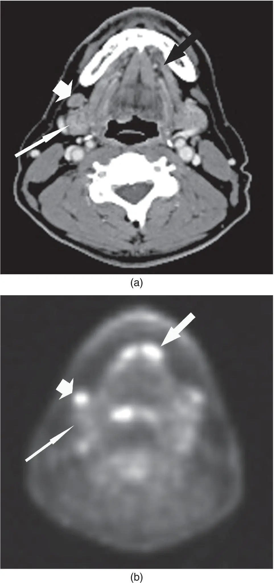Figure 229 CT a and PET b images in axial plane demonstrating normal - фото 49