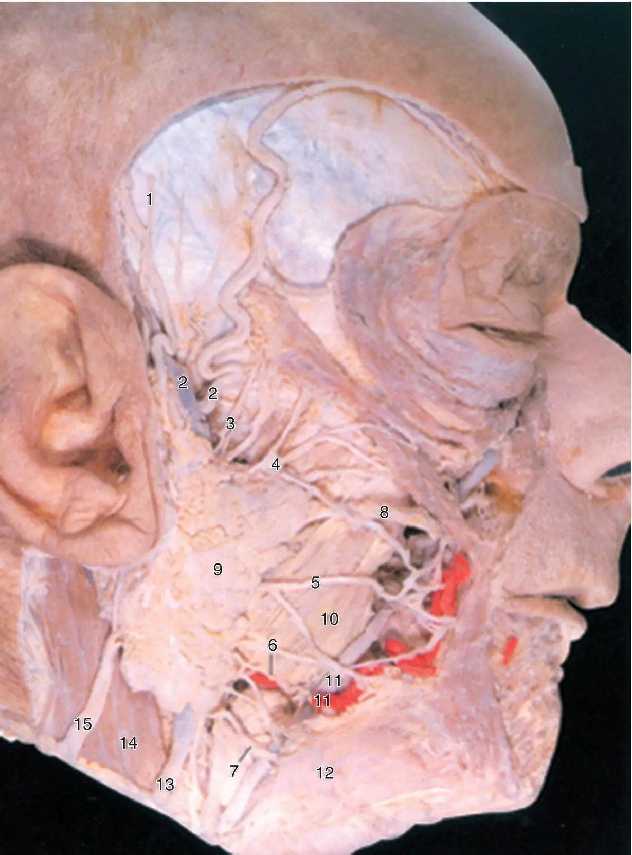 Figure 12 The parotid gland and associated structures Source Published with - фото 7