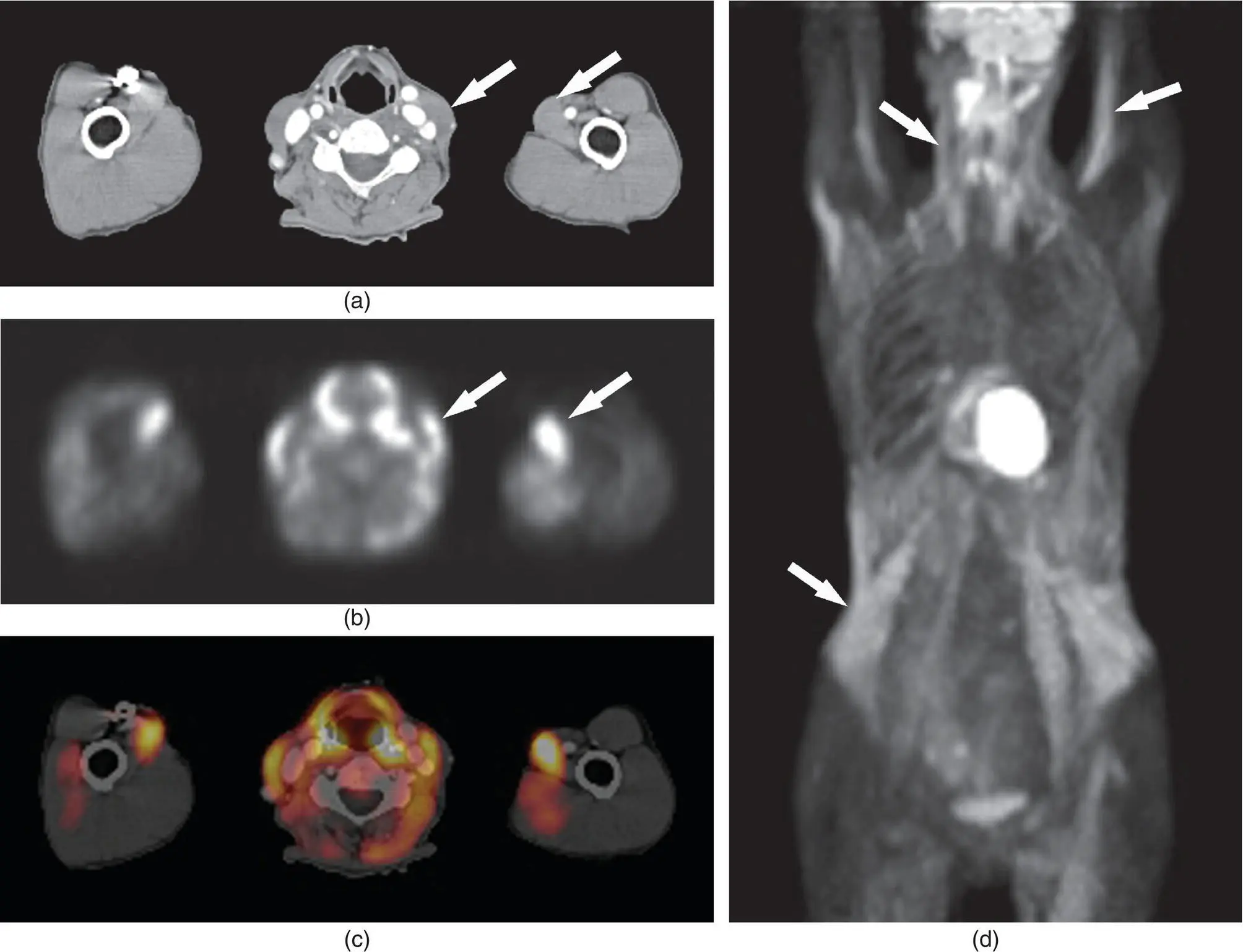 Figure 226 CT a PET b and fused PETCT c images in axial plane and an - фото 46