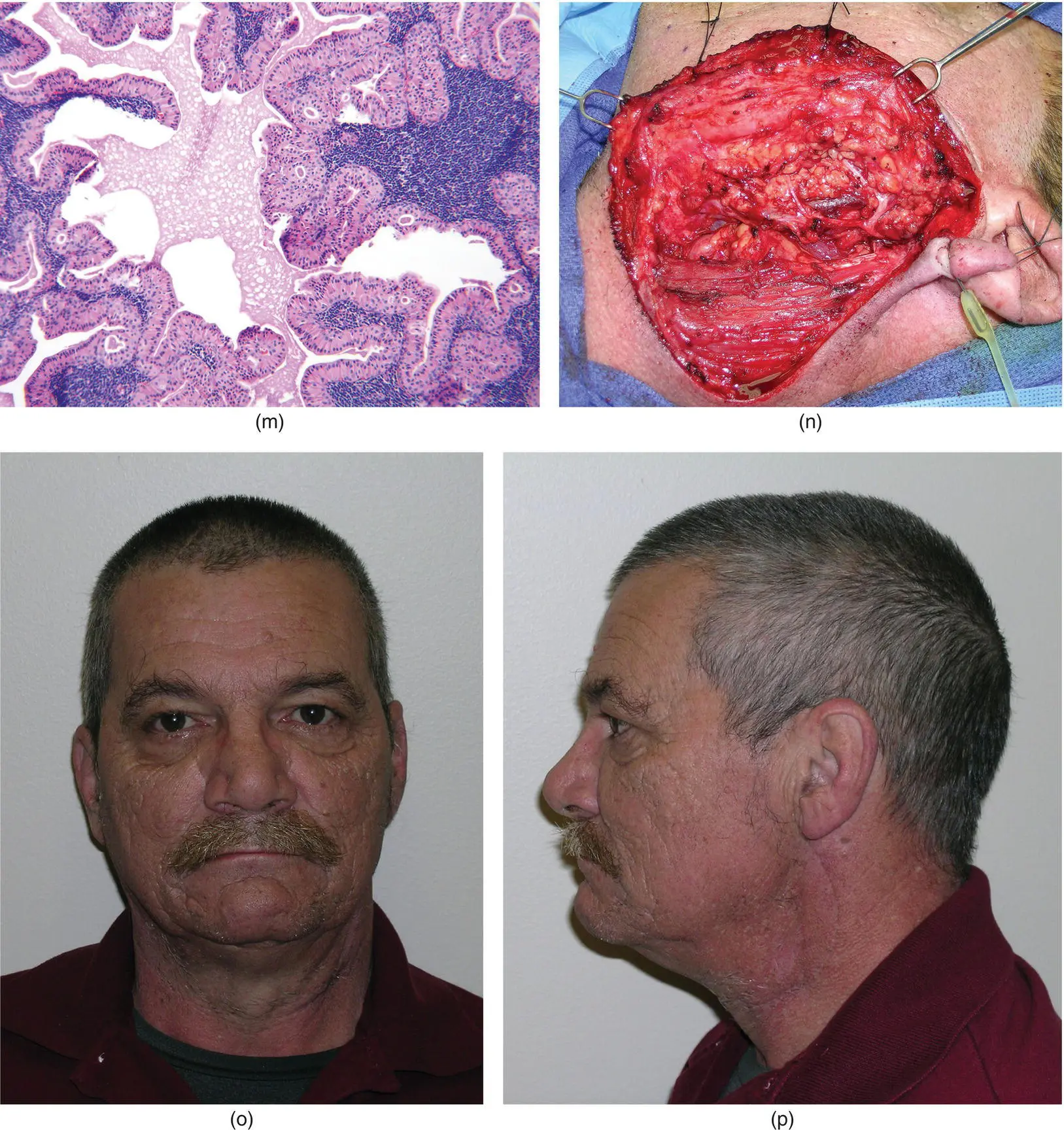 Figure 285 The patient demonstrates obvio - фото 108