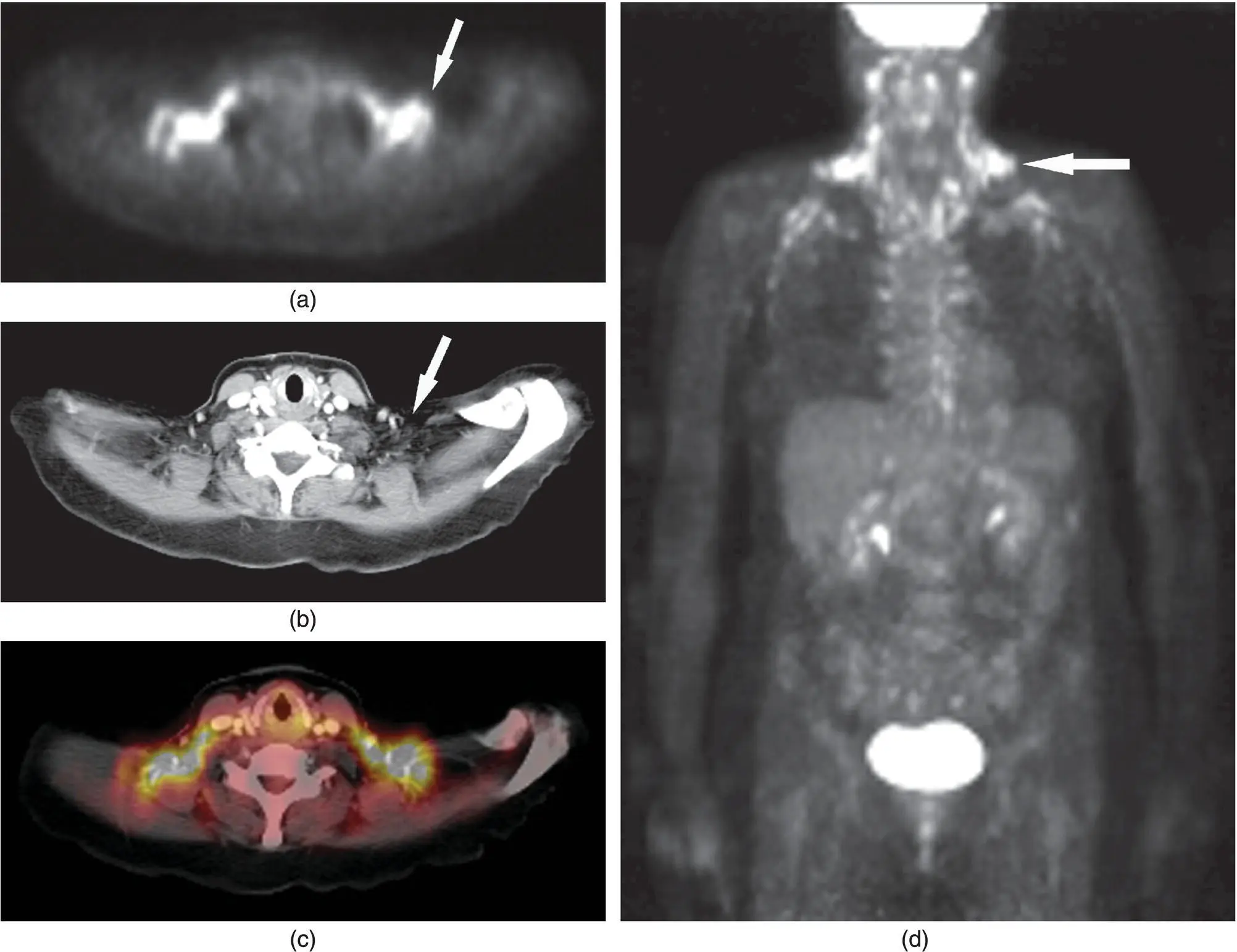 Figure 227 PET image a corresponding CT image b and a fused PETCT image - фото 47
