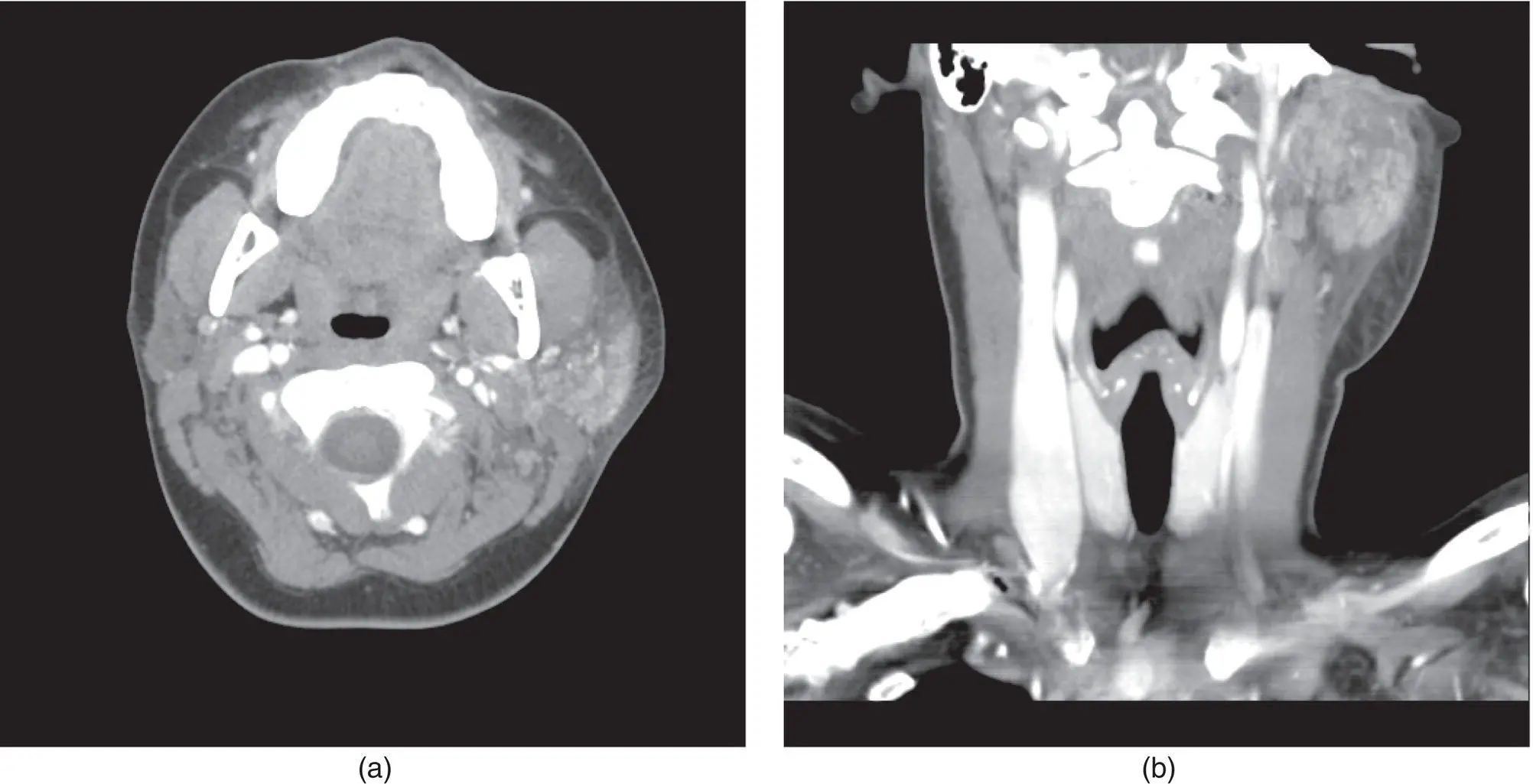 Figure 37 Axial a and coronal b CT scans of a patient with a hospital - фото 117