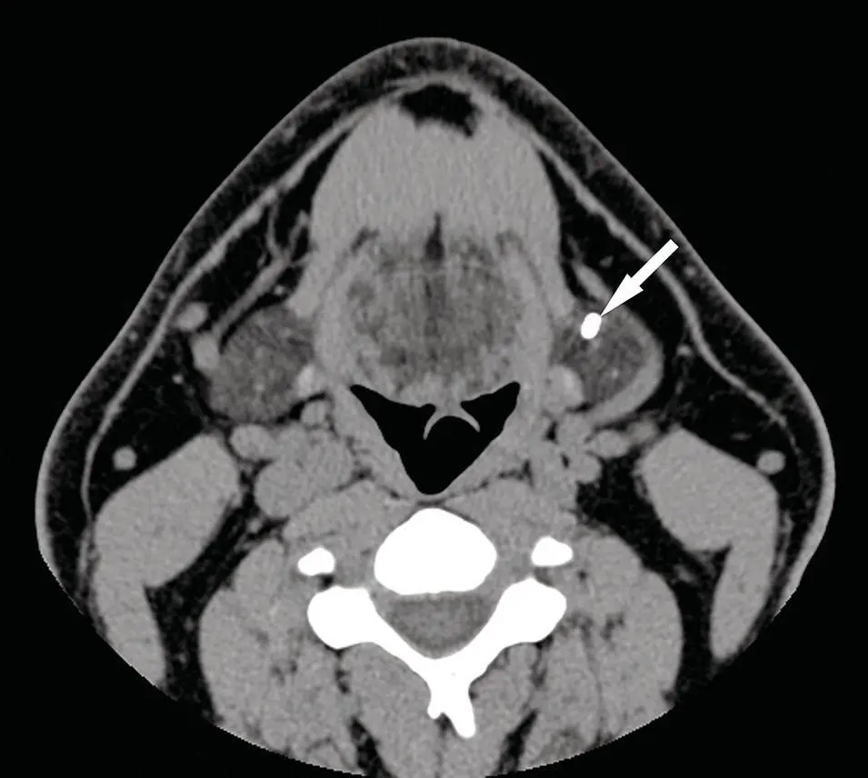Figure 21 Axial CT of the neck in softtissue window without contrast - фото 21
