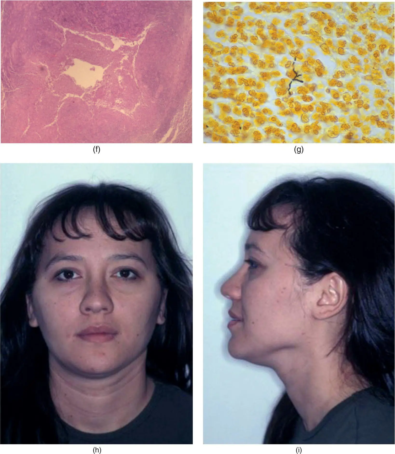 Figure 316 A 21yearold woman a with a twoweek history of left - фото 133