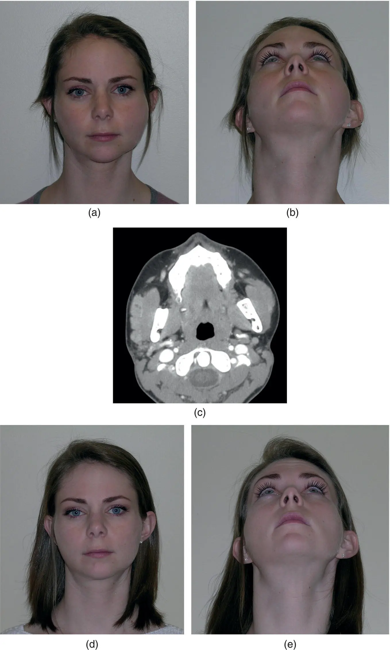 Figure 320 A 21yearold woman a and b with a threeweek history of left - фото 137
